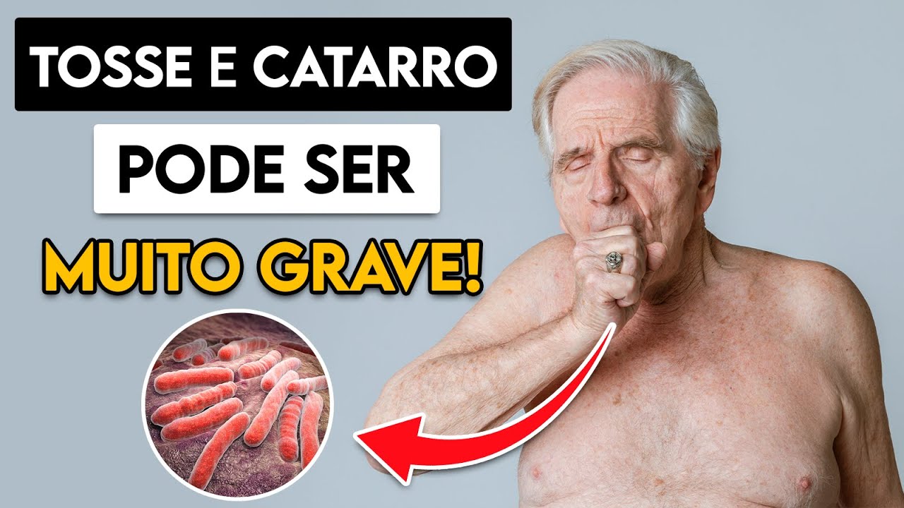 A TOSSE com (ou sem) CATARRO pode ser GRAVE! │ Médico Explica