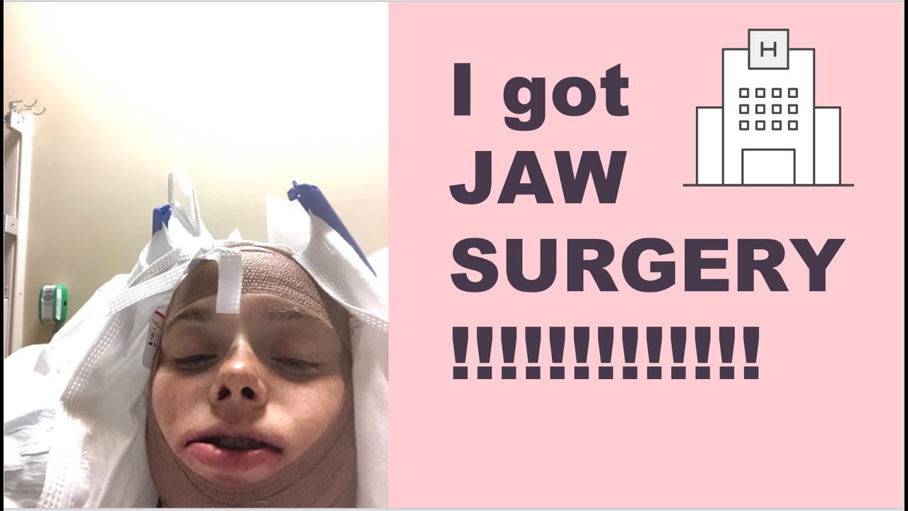 I had jaw surgery!!!! First two weeks of recovery vlog