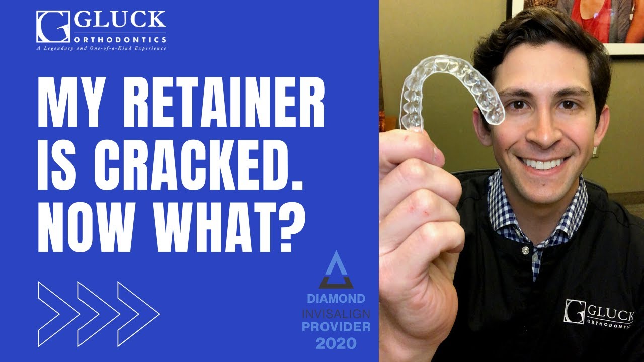 Cracked Retainer After Braces or Invisalign: Now What?