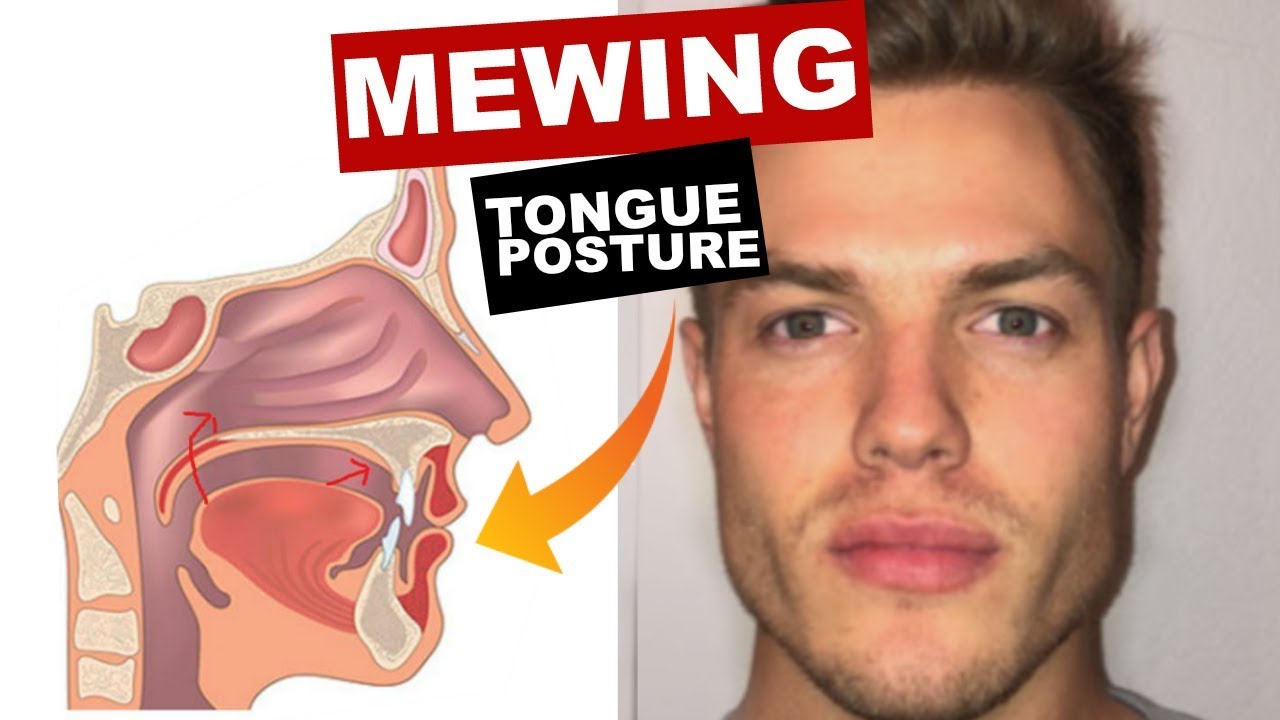 MEWING Tongue Posture | Train Your Tongue to Attach to Your Mouth