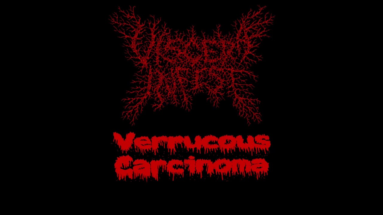 Paracoccidioidomicosisproctitissarcomucosis - Viscera infest