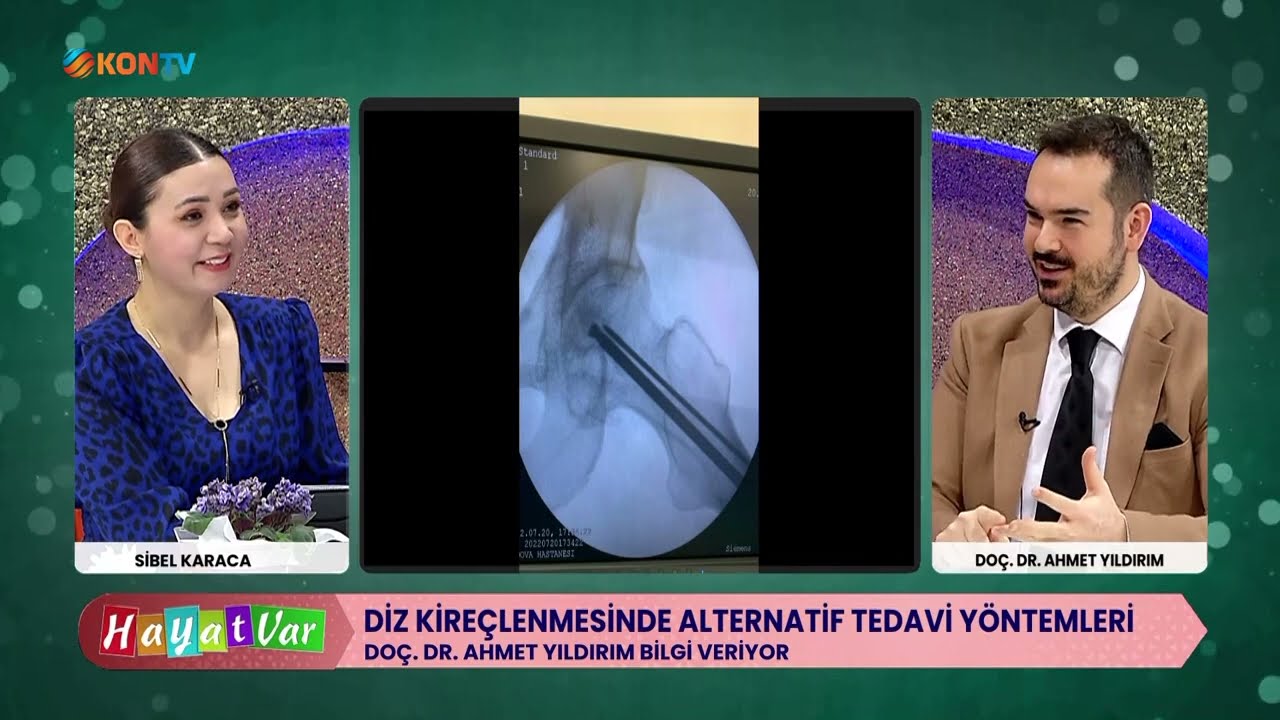 Doç.Dr. Ahmet Yıldırım Diz Kireçlenmesinde Kök Hücre Tedavisi ve Prp İle Tedavi Edilecek Hastalıklar