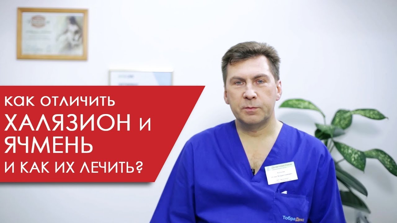 Как отличить халязион и ячмень и как эти заболевания лечить?