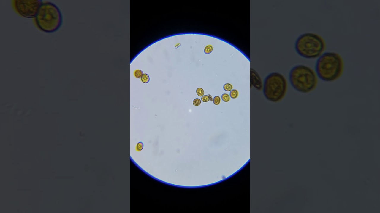 Dinoflagellates ID?