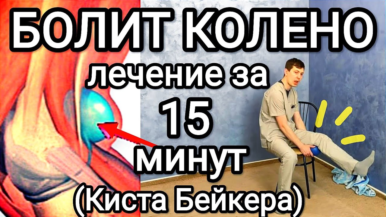 Болит колено! Лечение за 15 минут - КИСТА БЕЙКЕРА(Беккера)