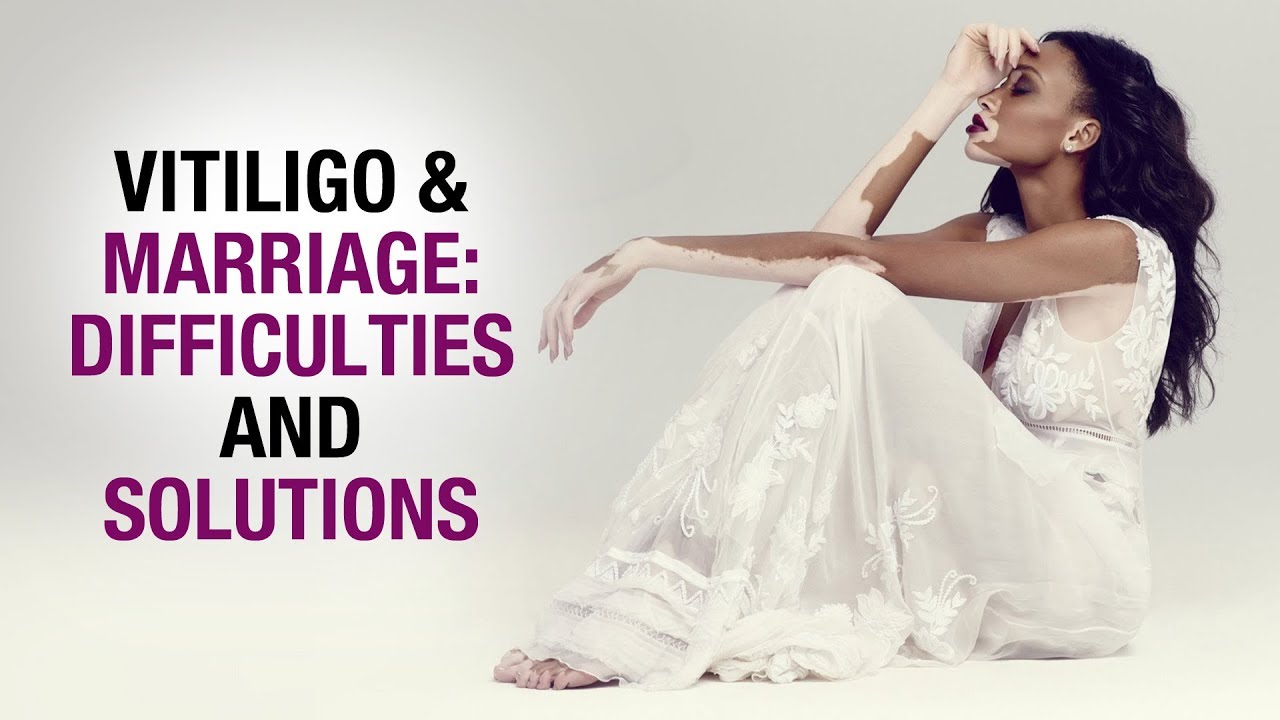 Vitiligo & Marriage: Difficulties and Solutions || Aimil Healthcare || Dr. Nitika Kohli