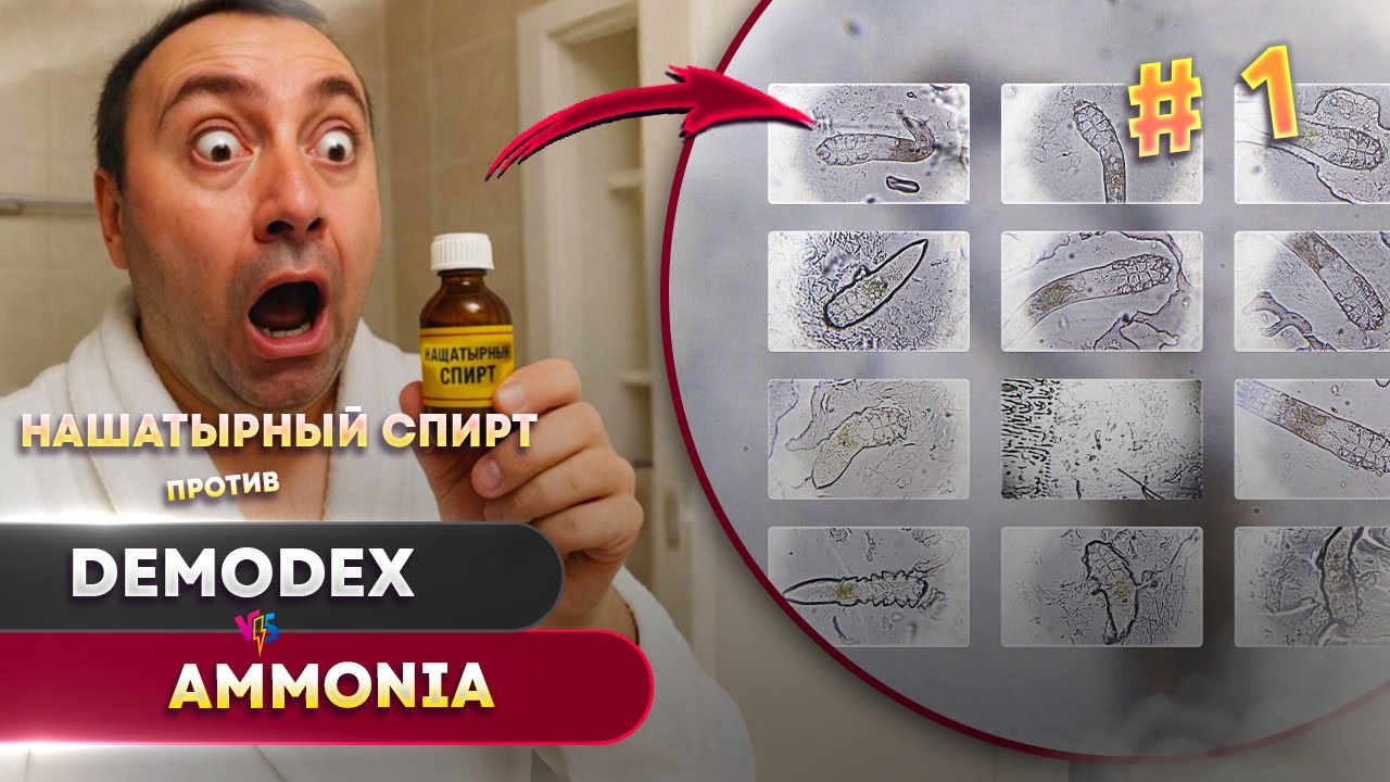 🧪Нашатырный спирт 10% против клещей Демодекс &mdash; неожиданная реакция под микроскопом! #1