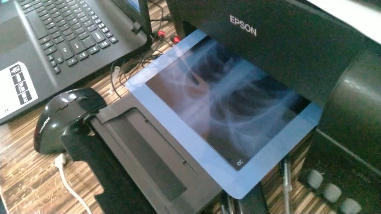 KVP - XRAY FILM PRINTING USING DESKTOP PRINTER