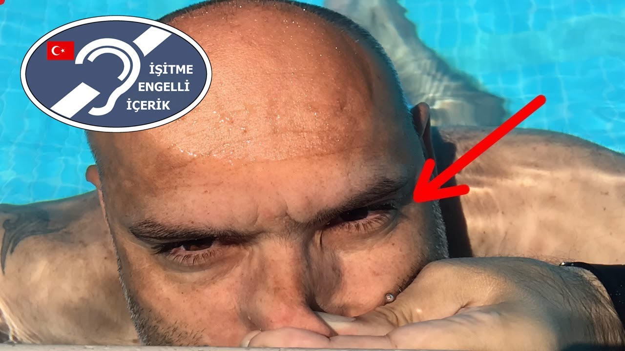 SUDA GÖZ NASIL AÇILIR? (İşitme Engelliler İçin Yazı Dilinde Türkçe İçerik)