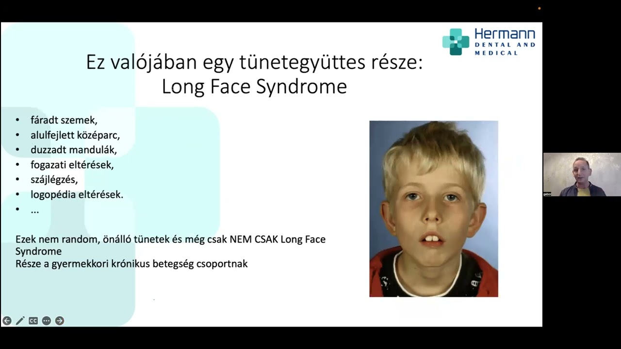„Harapj az egészségbe!” – A száj új szerepe a funkcionális gyógyászatban