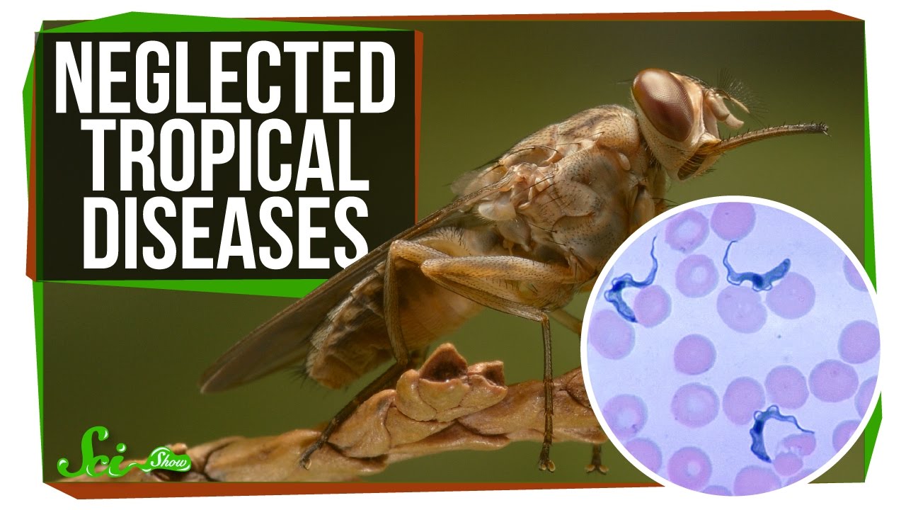 3 Deadly Diseases You've Probably Never Heard Of