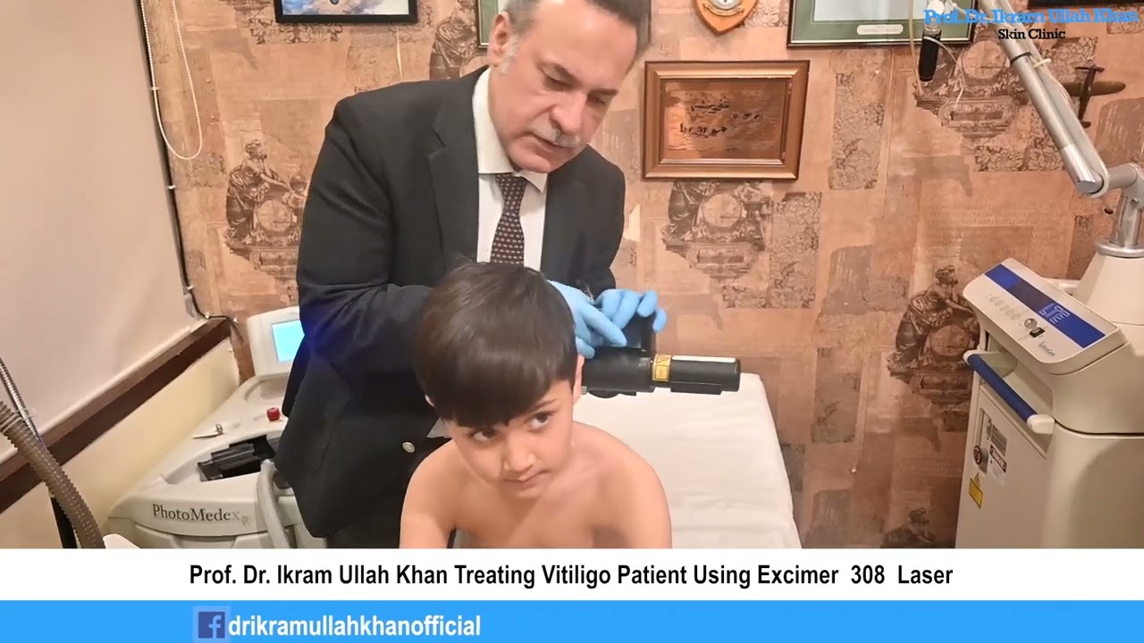 Live and Unfiltered: See the Magic of Vitiligo Laser Treatment! #livelasertreatment #vitiligo