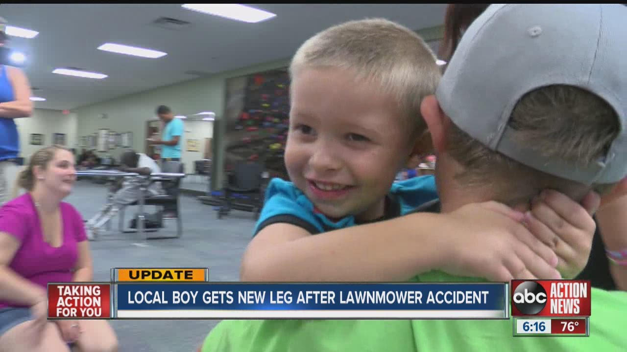Boy who lost leg in lawn power, walks again