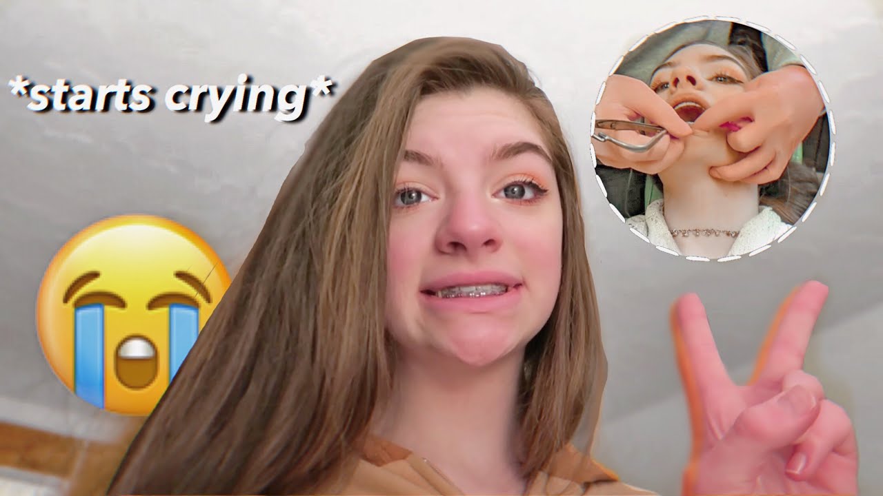 braces update: I GOT RUBBER BANDS AGAIN ?! | Lauren Hennessy