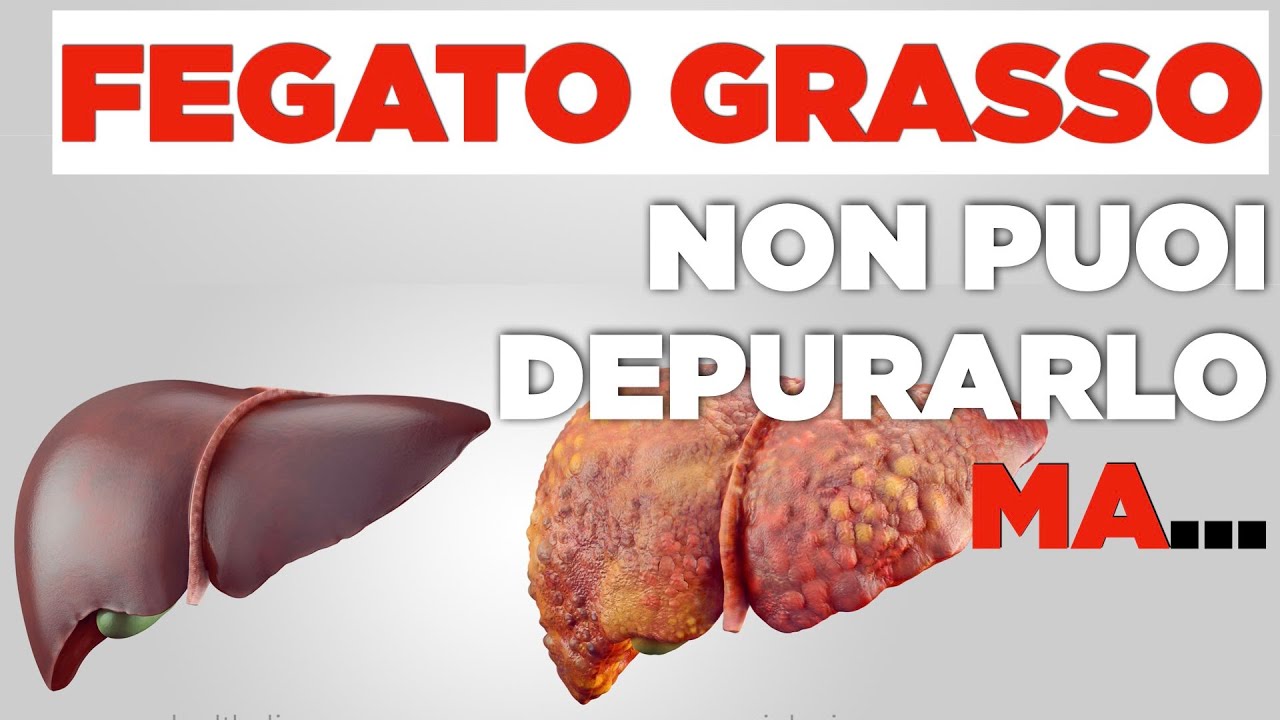 FEGATO GRASSO: non si può depurare ma ecco cosa possiamo fare
