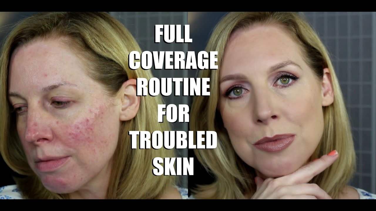 FULL COVERAGE ROUTINE FOR TROUBLED SKIN