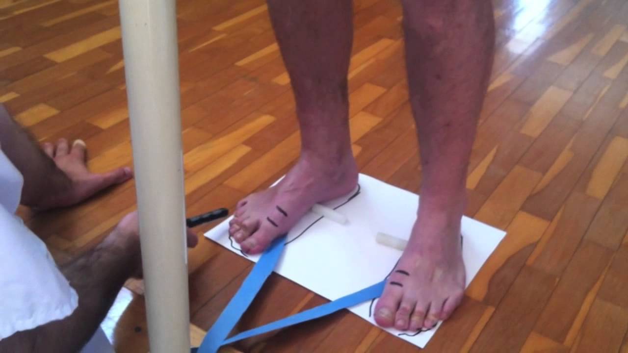 Pie plano/pronado y ejercicios correctivos de fisioterapia.
