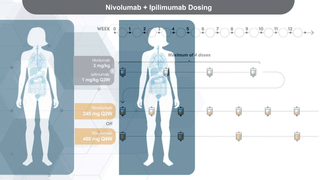 Standard and Alternative Dosing Regimens of Immunotherapies and Combinations in Modern Oncology