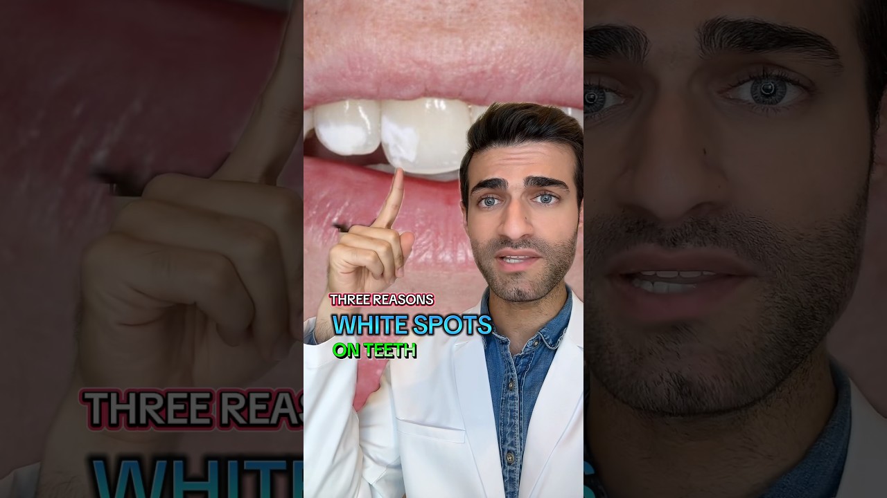 White Spots on Teeth - What You Can Do!? 
