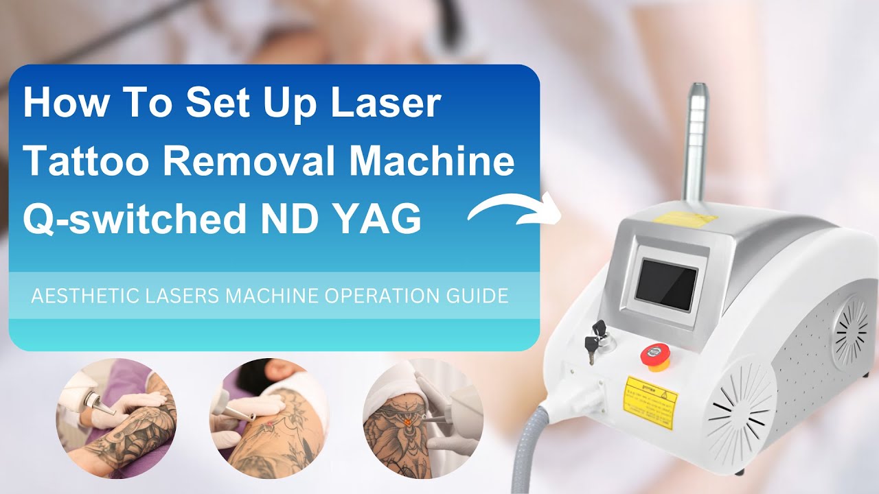 Quick Start: Canta Esthetic's ND YAG Laser Tattoo Removal Guide
