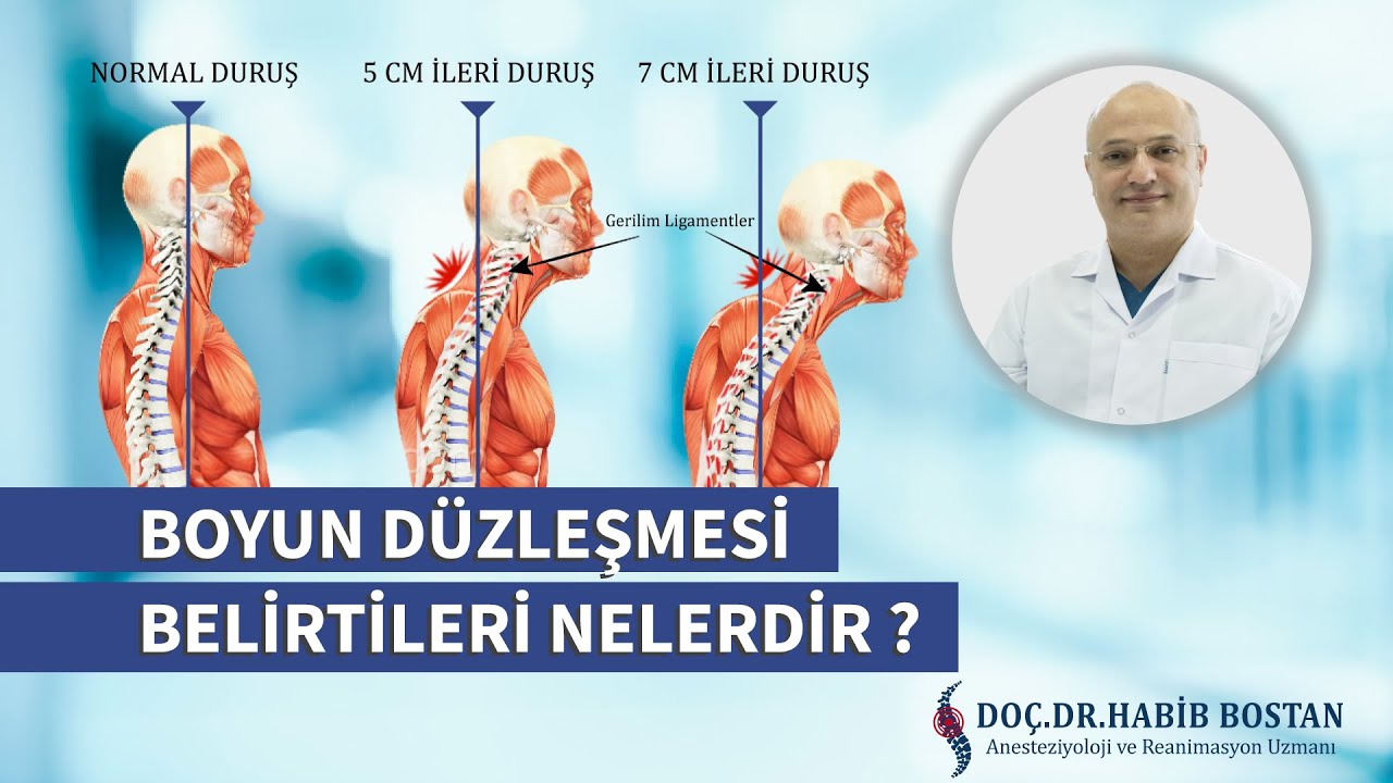 DOÇ. DR. HABİB BOSTAN - BOYUN DÜZLEŞMESİ BELİRTİLERİ NELERDİR ?