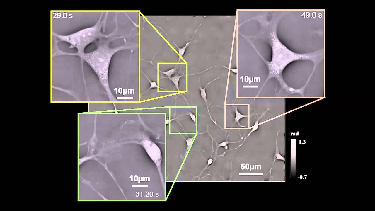 Quantitative differential phase contrast imaging in an LED array microscope