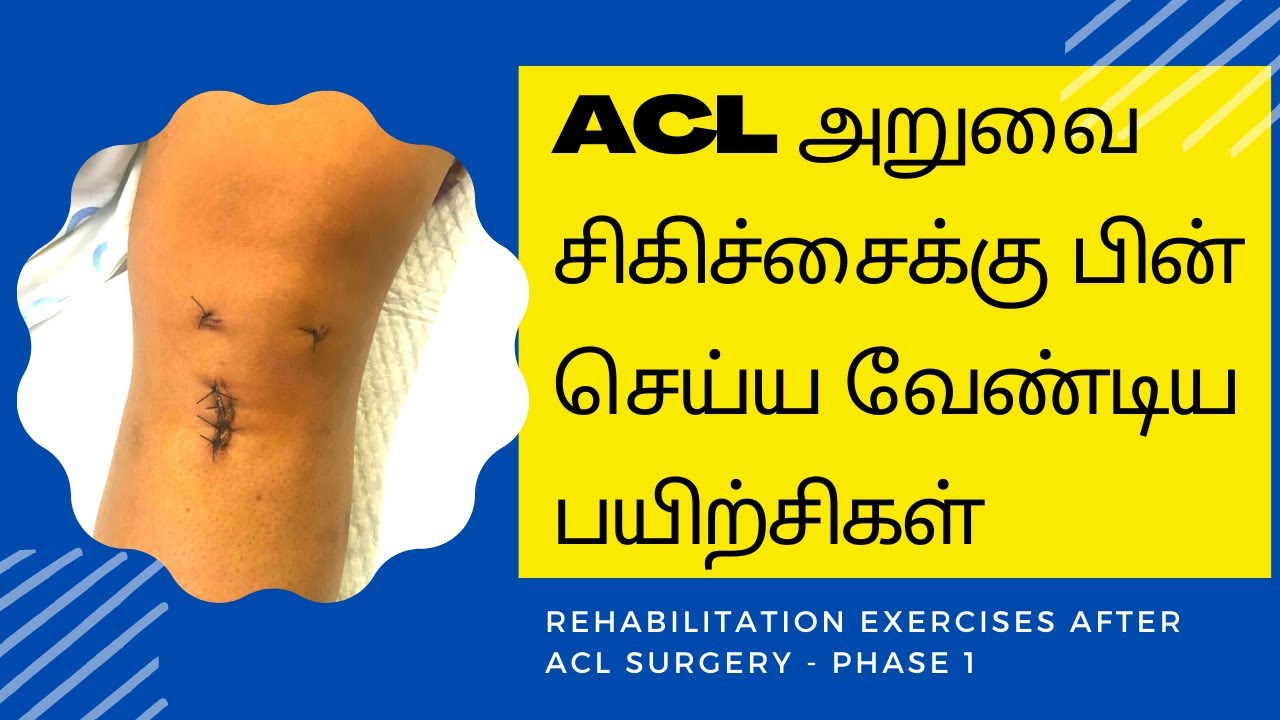 முழங்கால் ACL ஜவ்வு பாதிப்பு அறுவை சிகிச்சைக்கு பின் செய்ய வேண்டிய பயிற்சிகள் - DrJV