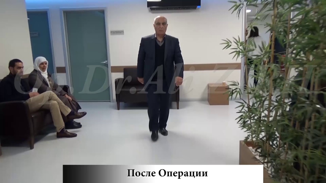 Rafig HASANOV / До и После Операции