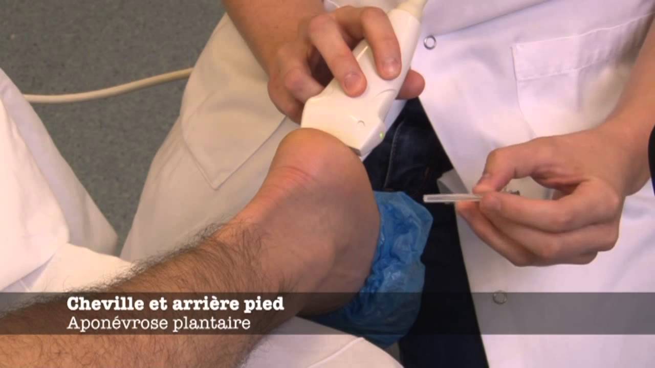 Echoms.info - Apon&eacute;vrose plantaire