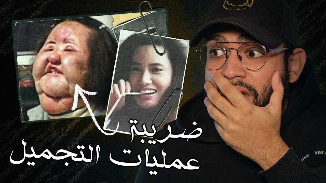 مغنيه كوريه تحقن نفسها بالزيت لكي تكون 