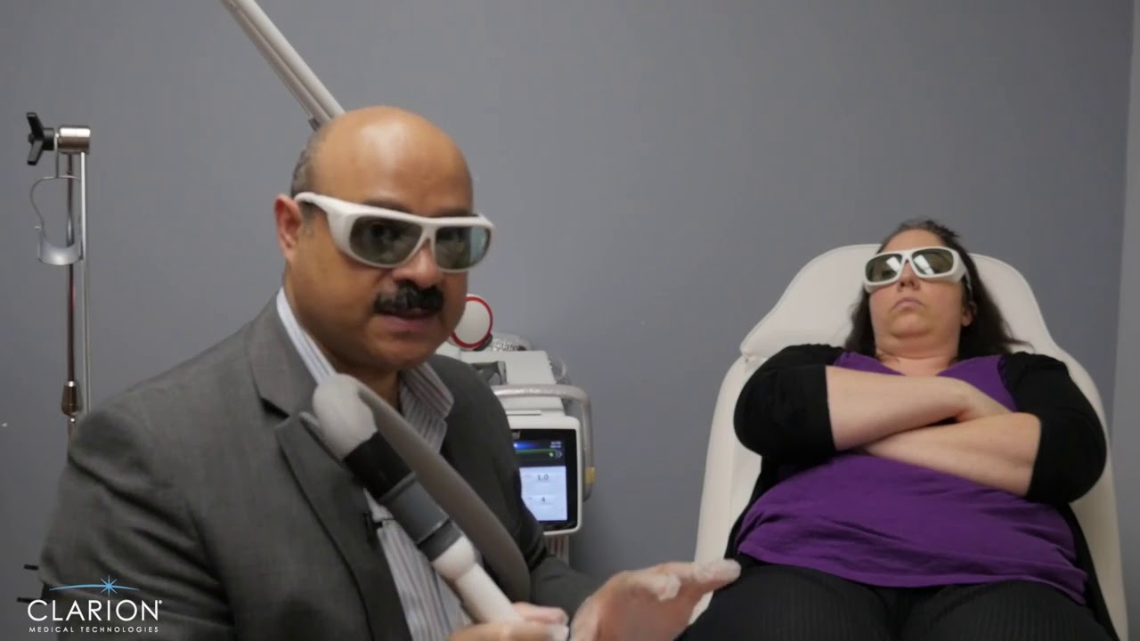 Leg Veins treatment