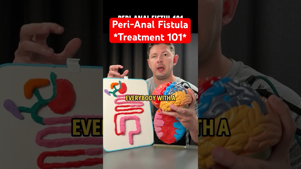 Crohn&rsquo;s Perianal Fistula &ndash; The Real Root Cause