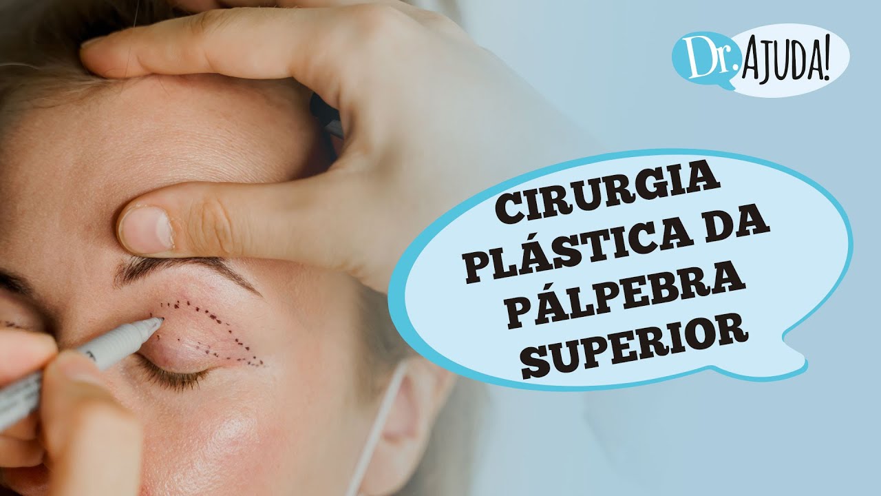 PL&Aacute;STICA DOS OLHOS: P&Aacute;LPEBRA CA&Iacute;DA E CIRURGIA DE BLEFAROPLASTIA