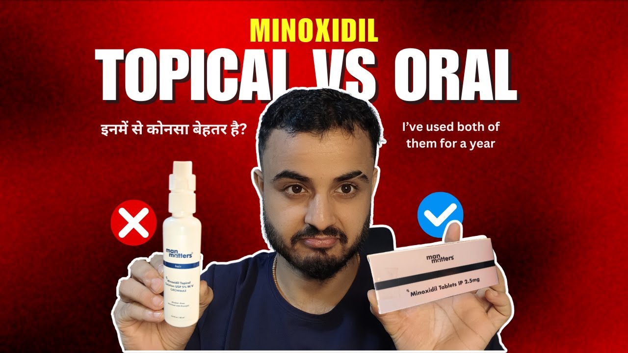 Minoxidil Oral Vs Topical | Which one is Best| I used both of them & here's my results