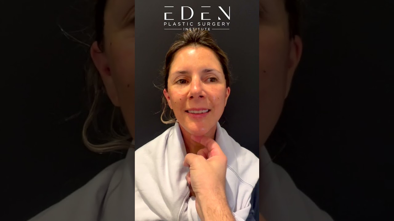 Miami FL Neck Lift | Get Rid of Turkey Neck | Eden Plastic Surgery: Dr. Ali Charafeddine
