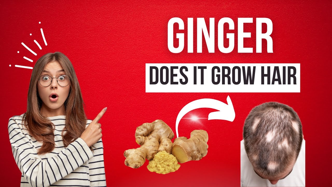 GINGER AND HAIR LOSS: THE REAL DEAL