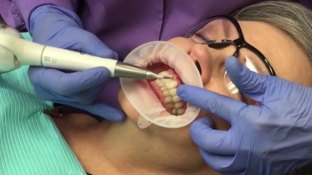 AIR-N-GO EASY Implant Maintenance Protocol