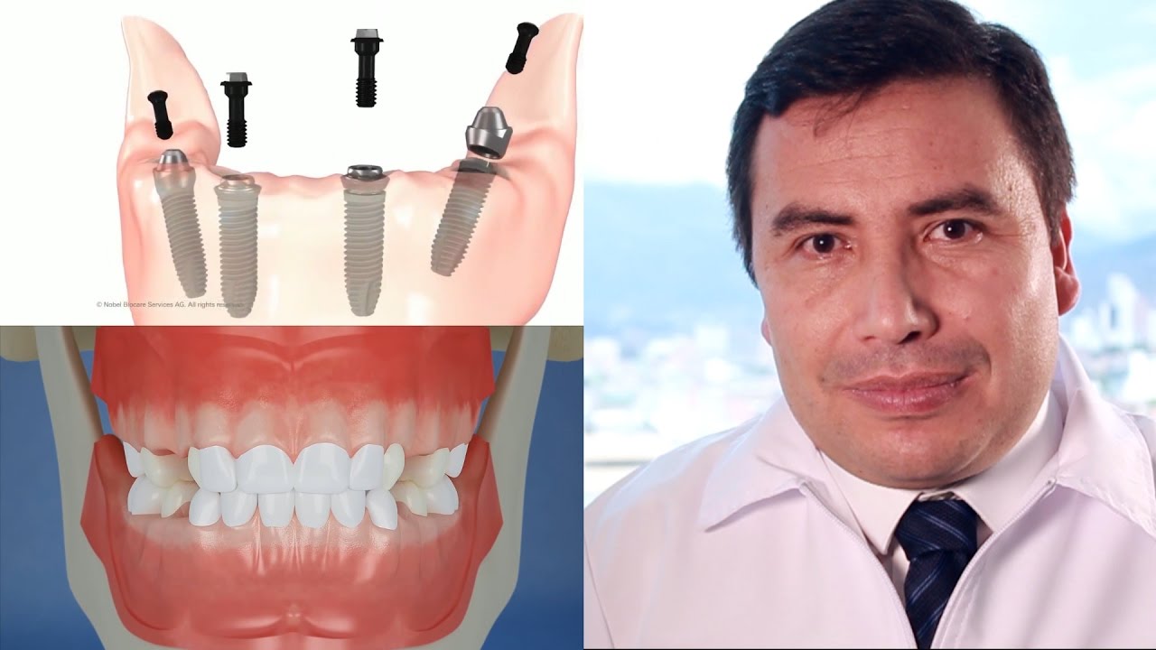 Rehabilitaci&oacute;n Oral en Oralstudio