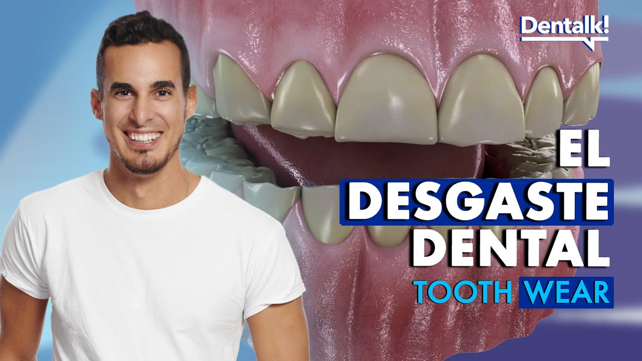 ¿DIENTES DESGASTADOS? - Causa y TRATAMIENTO de abfracción, atrición y otros desgastes | Dentalk! ©