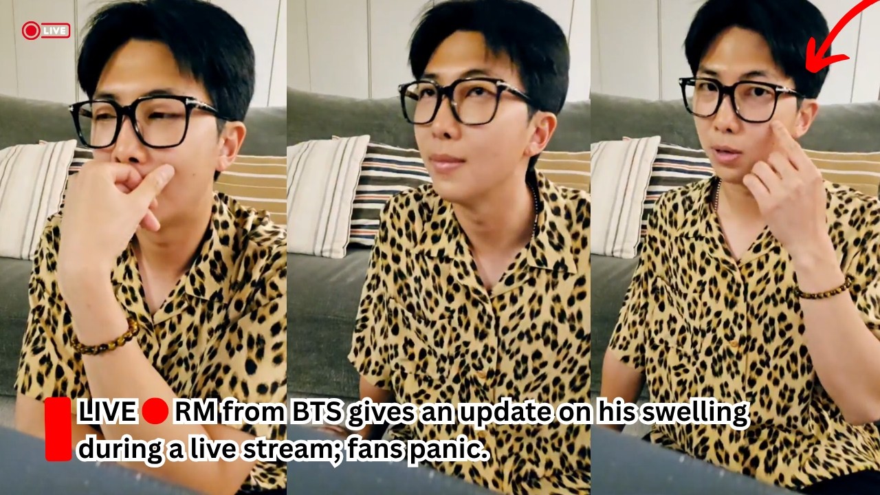 RM from BTS gives an update on his swelling during a live stream; fans panic.