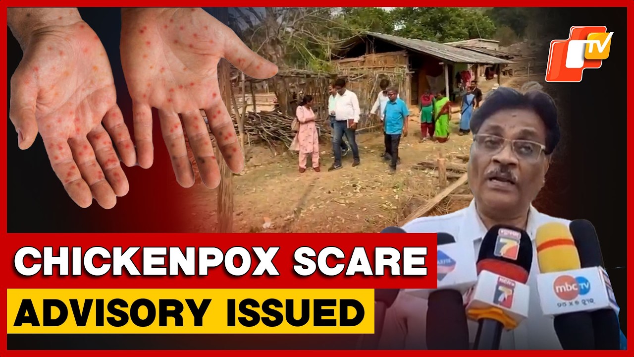 Health Officials Issue Advisory After Chickenpox Cases In Gajapati Village| Odisha