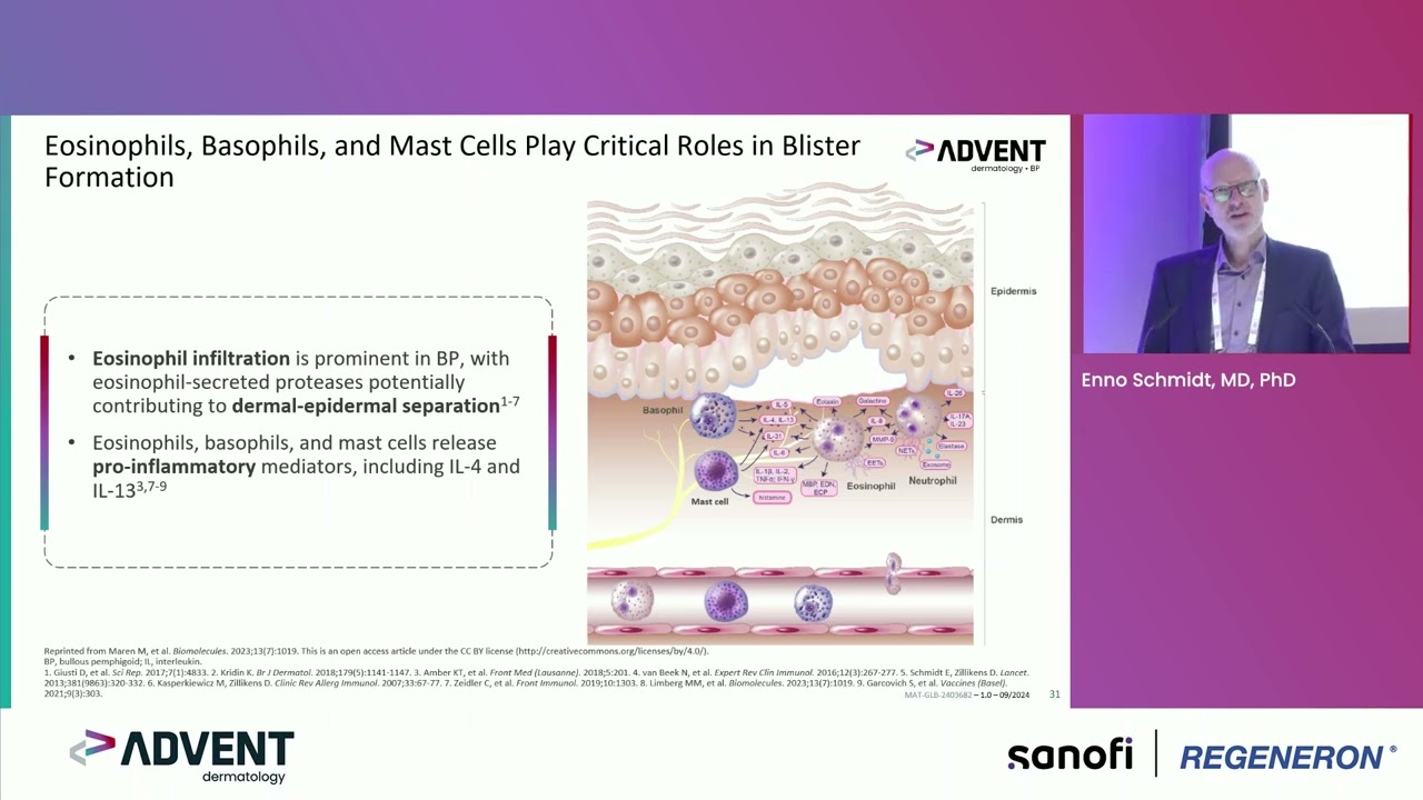 Mechanisms of Disease: Autoimmunity and Role of Type 2 Inflammation in BP