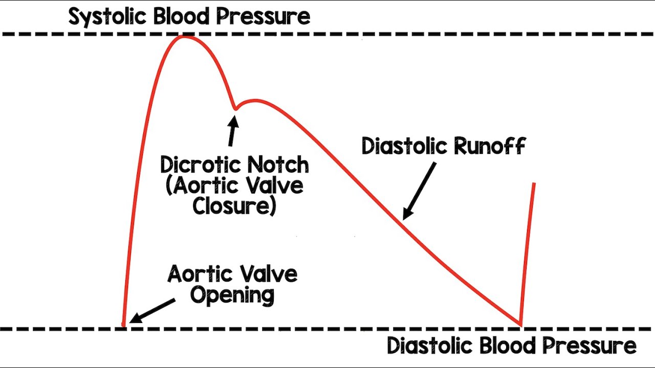 A-Lines и демпфирование