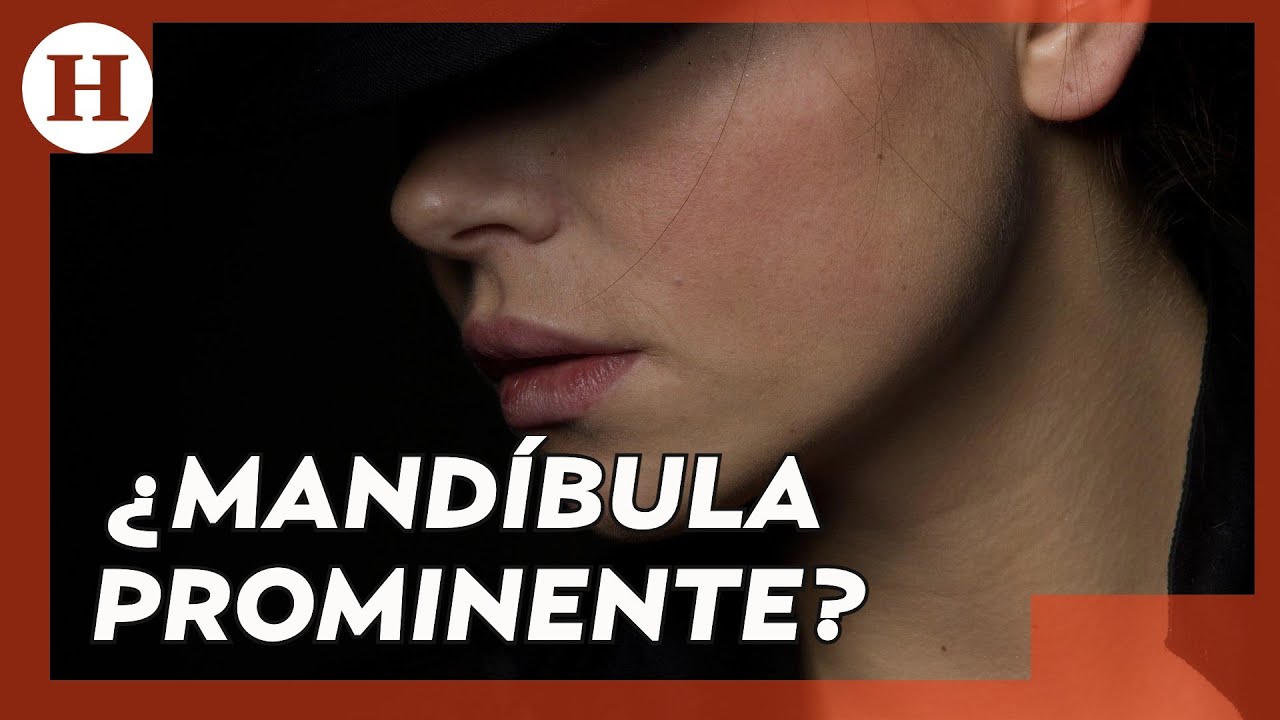 #CodigoSalud | ¿Tienes una #mandíbula prominente? Este es el costo de la cirugía