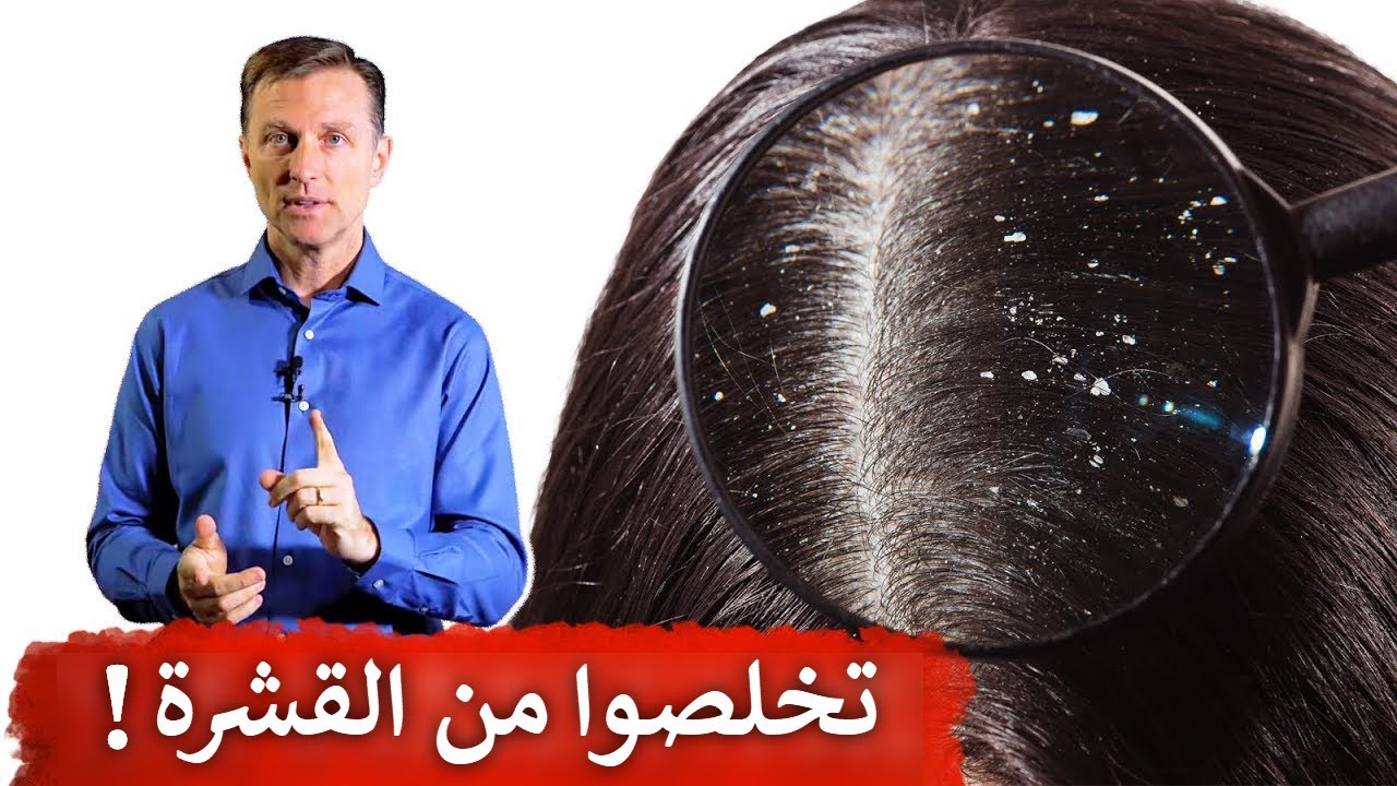 كيف نتخلص من القشرة دون رجعة!