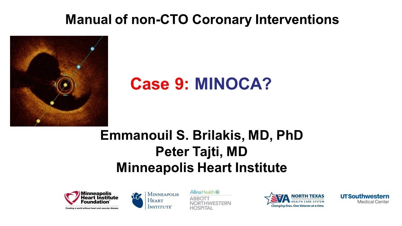 Случай 9: Руководство PCI - MINOCA?
