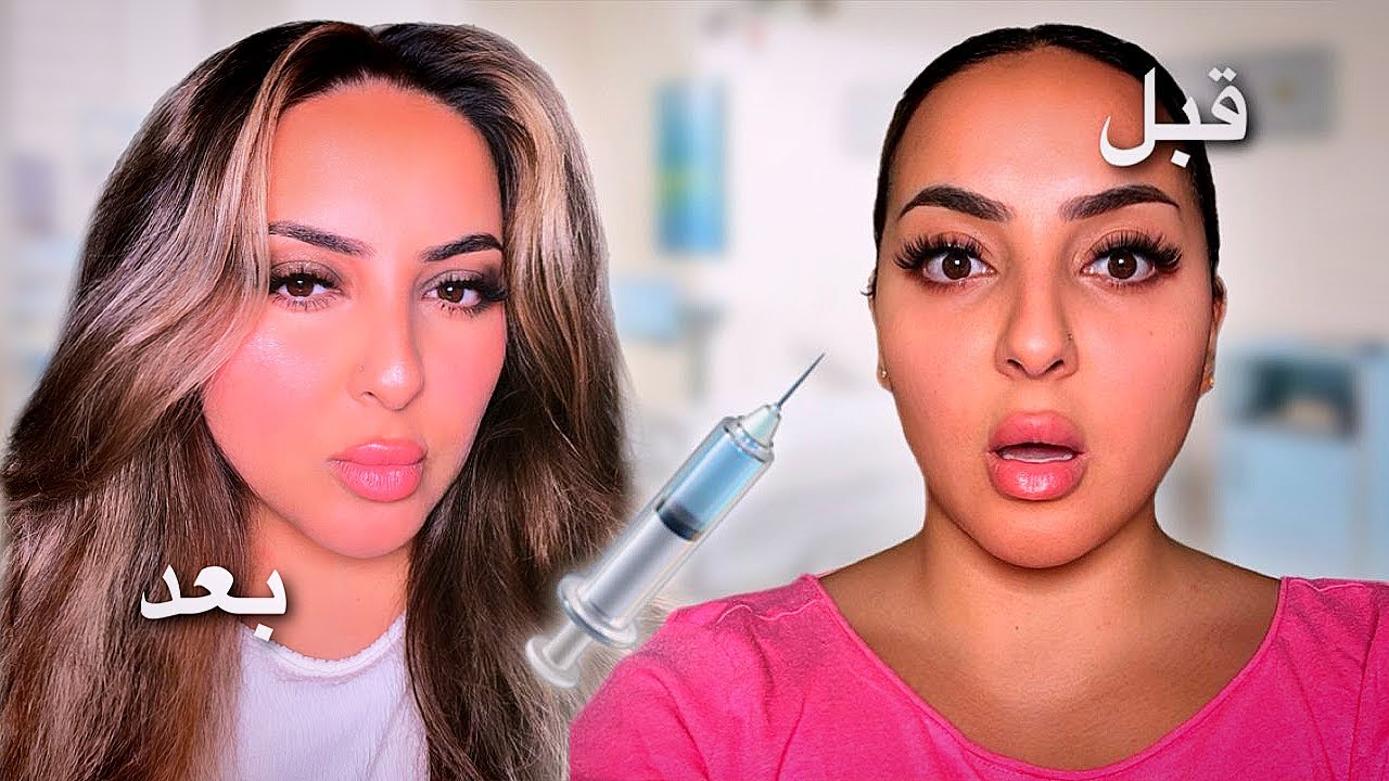 غيرت شكلي بالكامل 💉 تجميل كامل 🤩 