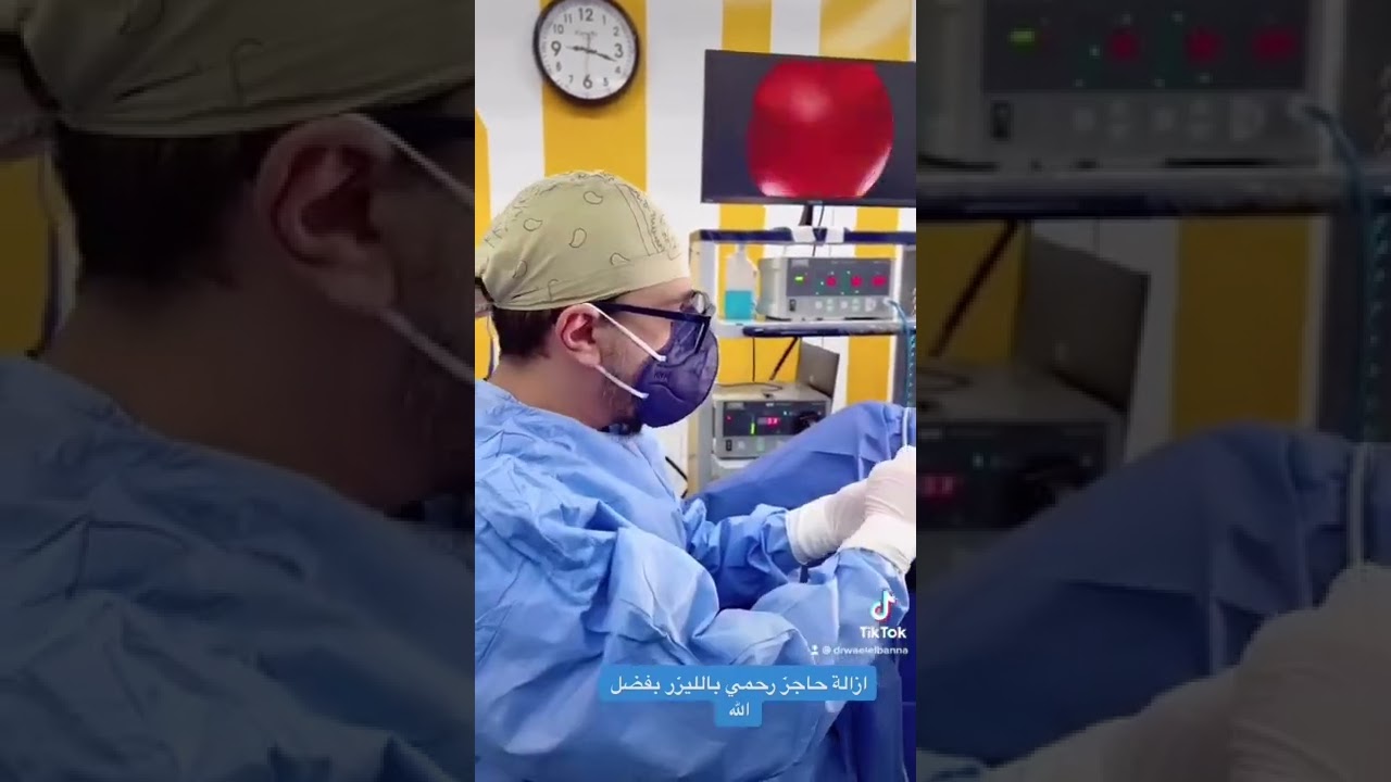 شرح استئصال حاجز رحمي بالليزر