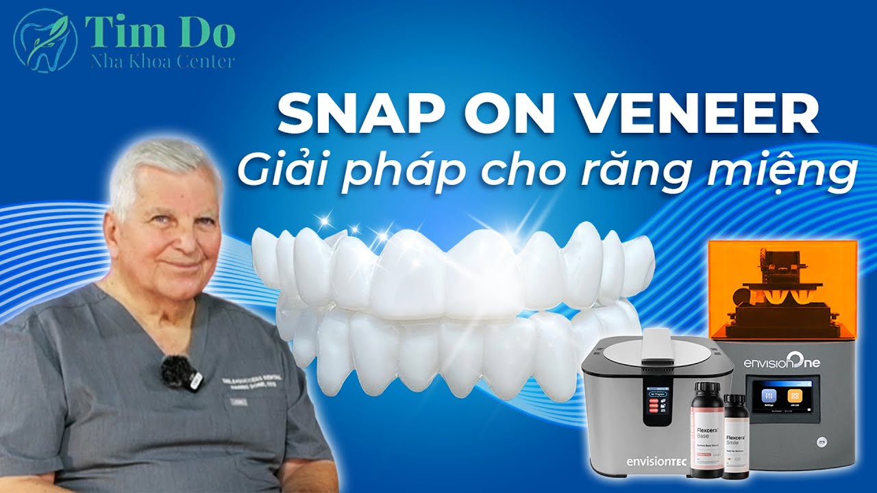#15  Snap On Veneers. Kỹ thuật mới trong nha khoa