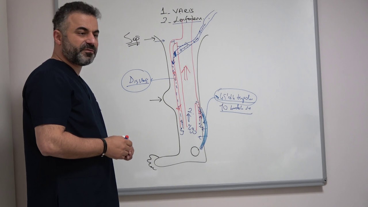 Vajinal ve kasık varisleri niye oluşur? - Prof. Dr. Ahmet AKGUL